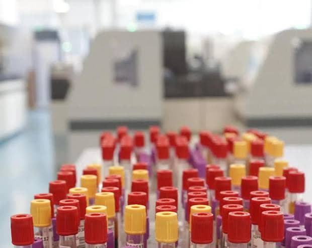 A Francoforte, i casi di malaria salgono a otto: tre decessi vicino all'aeroporto