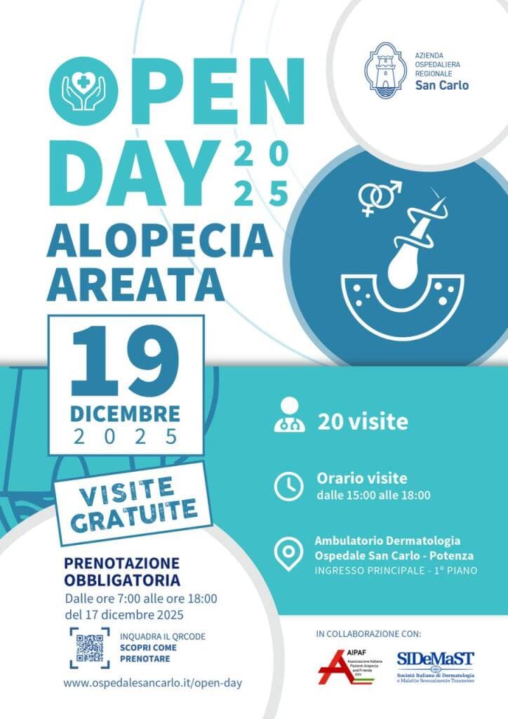 Alopecia areata, visite gratuite all’ospedale San Carlo di Potenza
